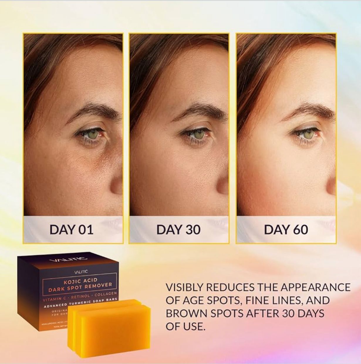 Soap | Kojic Acid Dark Spot Remover Soap Bars
